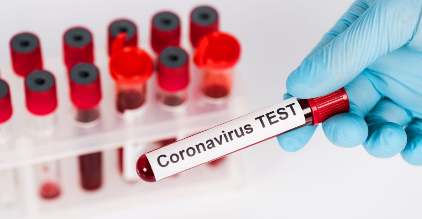 covid-19-test